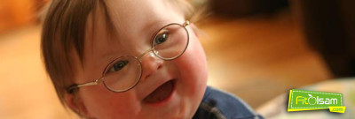 Down Sendromu Nedir?