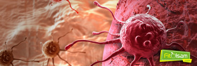 Kanser İçin Doğal Tedavi Yöntemleri