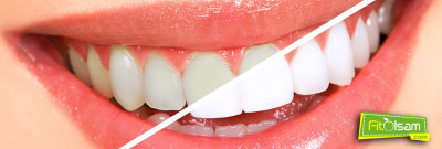 Evde Diş Beyazlatma Yöntemleri