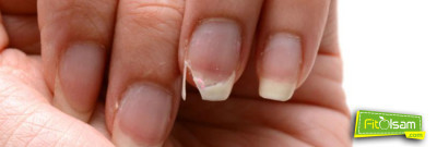 Tırnak Kırılmalarını Önlemek İçin 9 Yöntem