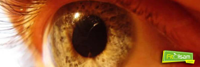 Sarı Nokta Hastalığı Nedir ve Belirtileri Nelerdir?