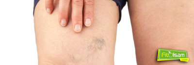 Varis Nedir? Nasıl Oluşur?