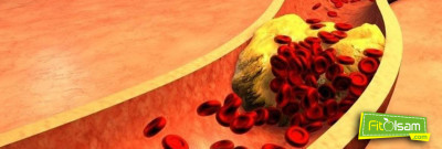 Damar Tıkanıklığı Nedir? Belirtileri Ve Tedavi Yöntemleri Nelerdir?