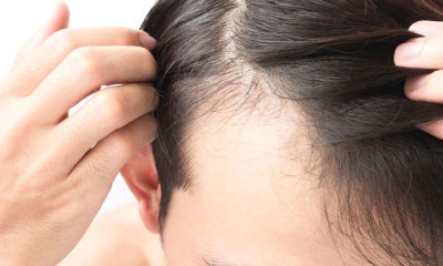 Saç Dökülmesine İyi Gelen Besinler