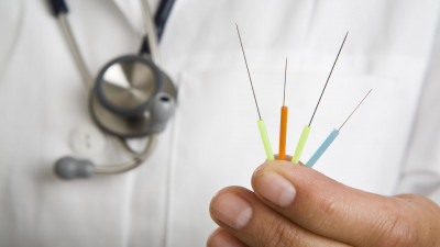 Akupunktur Nedir, Akupunktur ile Nasıl Zayıflarım?