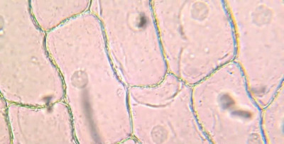 Epitel Hücre Nedir? İdrarda Epitel Hücre Tedavisi Nasıl Yapılır?