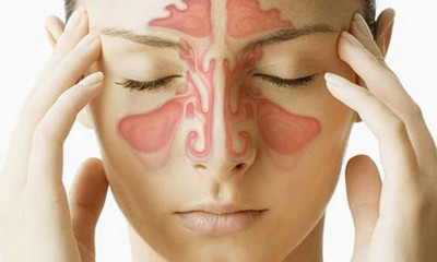 Burun tıkanıklığı nasıl geçer?