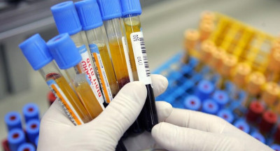 Kanda mch düşüklüğü nedir?