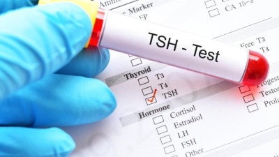 TSH değeri nedir? TSH testi neden yapılır?