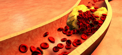 Kolesterol Nasıl düşer? Kolesterolü Düşüren Besinler Nelerdir?