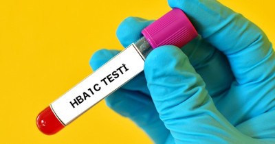 HBA1C testi nedir? HBA1C değeri kaç olmalıdır?