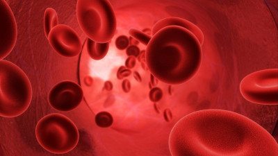 Hiponatremi  Nedir? Nedenleri Nelerdir? Tedavi Yöntemleri Nelerdir?