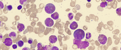 Eos Nedir? Düşüklüğü ve Yüksekliği Neyi İfade Eder?