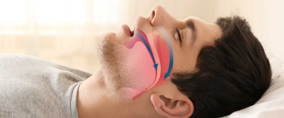 Horlama Nedir? Neden Olur? Doğal Tedavi Yöntemleri Nelerdir?