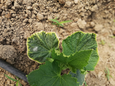 Potasyum Eksikliği Belirtileri Nelerdir? Potasyum Zengini Gıdalar Nelerdir?