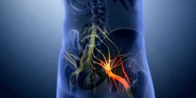 Siyatik Hastalığı Nedir? Belirtileri Nelerdir? Tedavisi Nasıl Yapılır?
